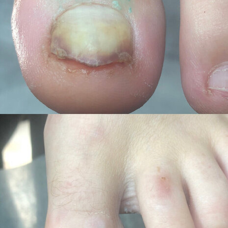 thumb