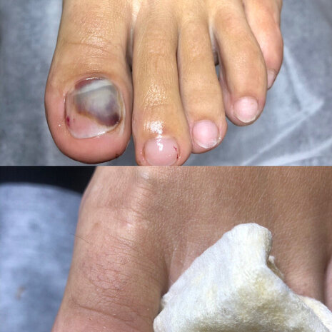 thumb