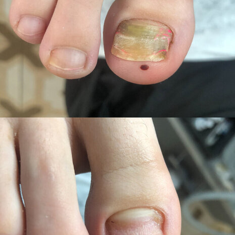 thumb