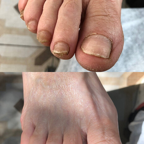 thumb