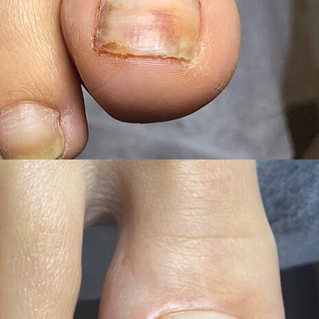 thumb