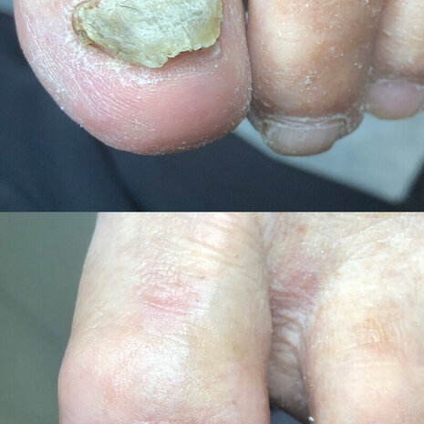 thumb