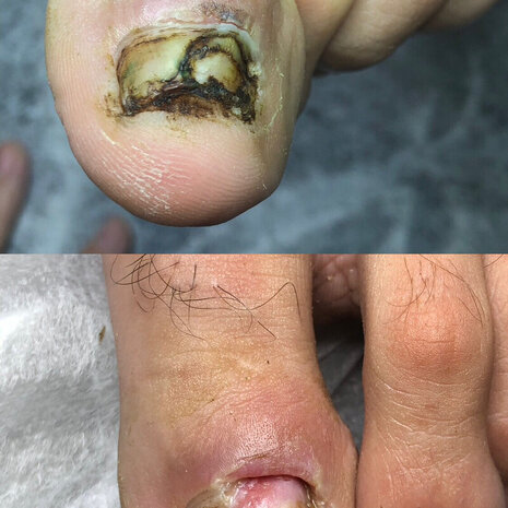 thumb