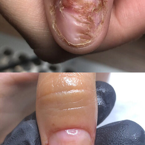 thumb