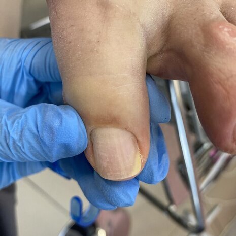 thumb