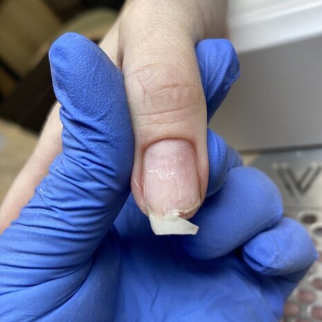 thumb