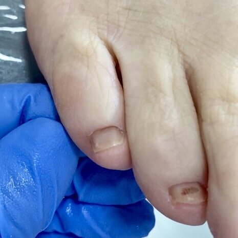 thumb