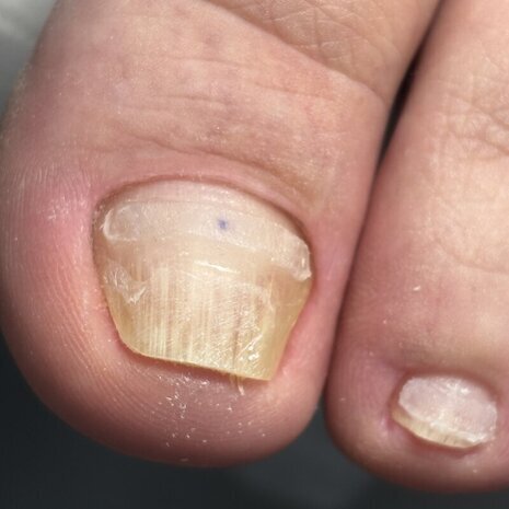 thumb