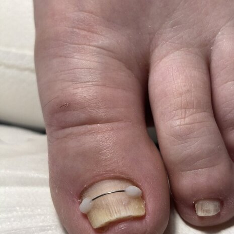 thumb