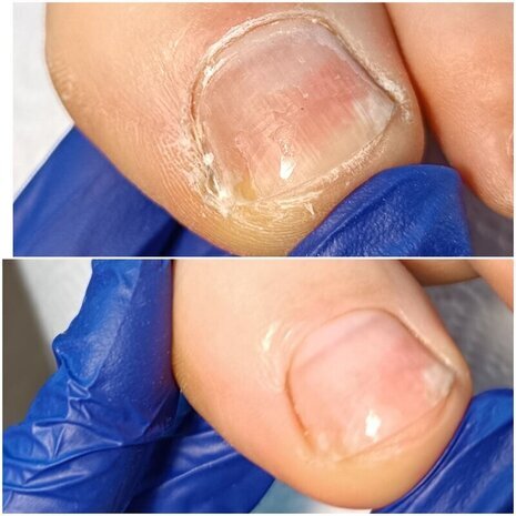 thumb