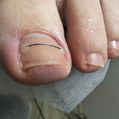 thumb