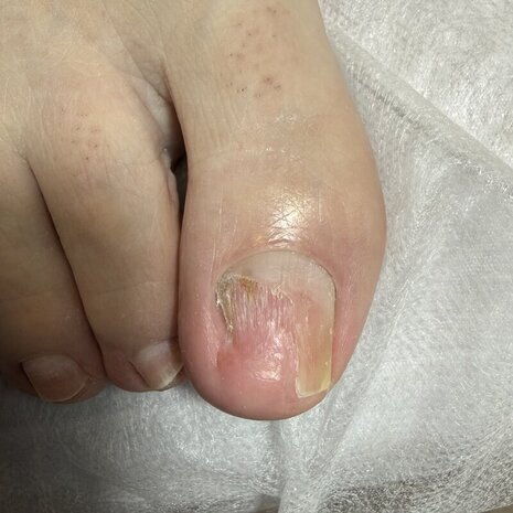 thumb