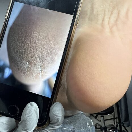thumb
