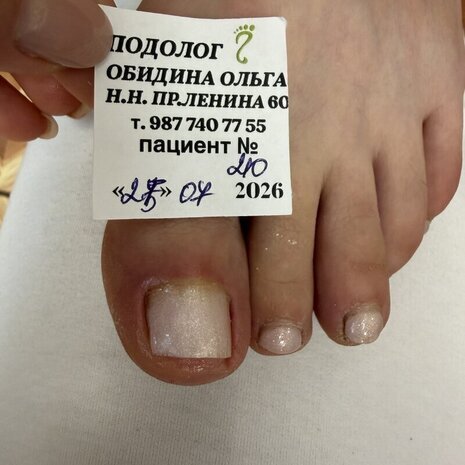 thumb