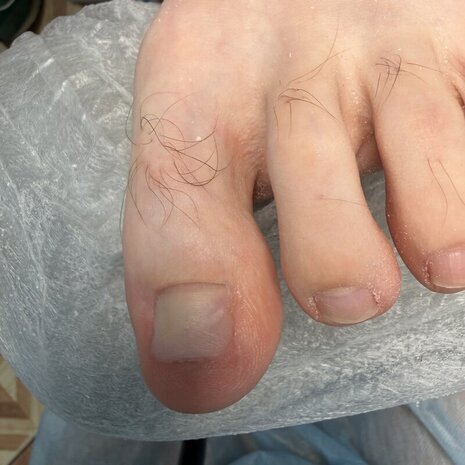 thumb