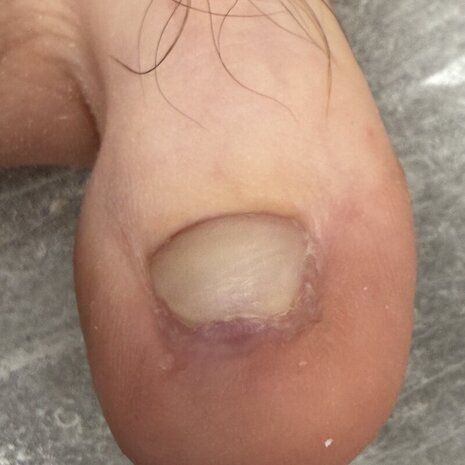 thumb