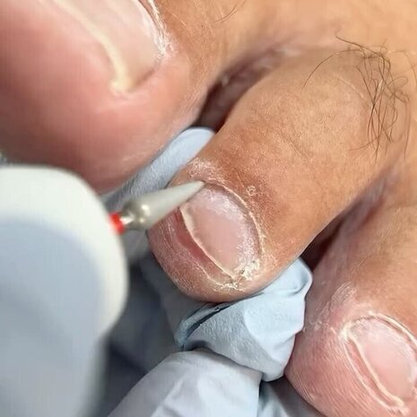 thumb