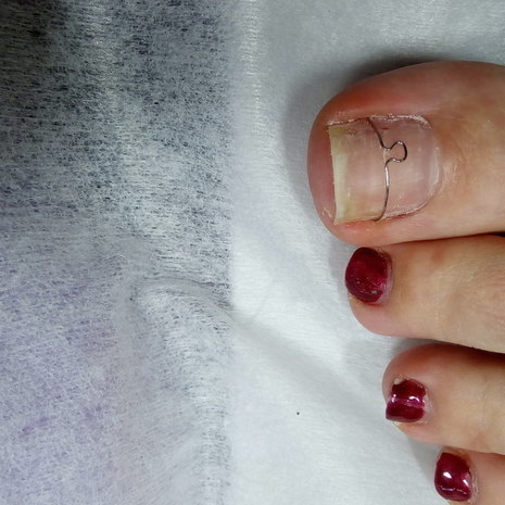 thumb