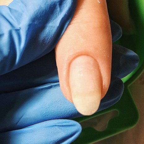 thumb