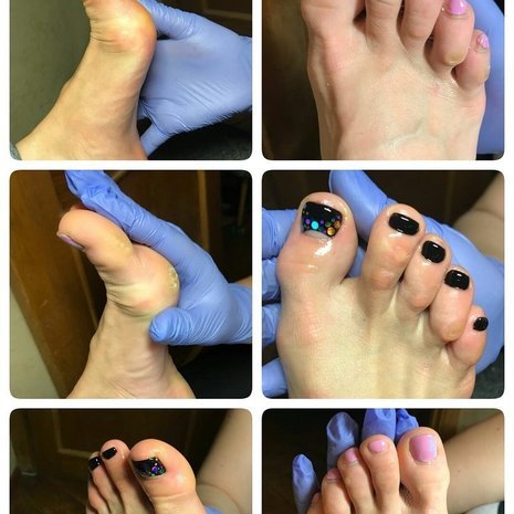 thumb