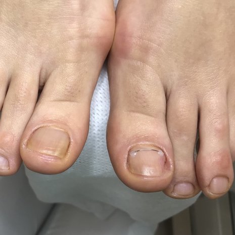thumb