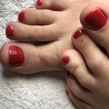 thumb
