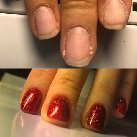 thumb
